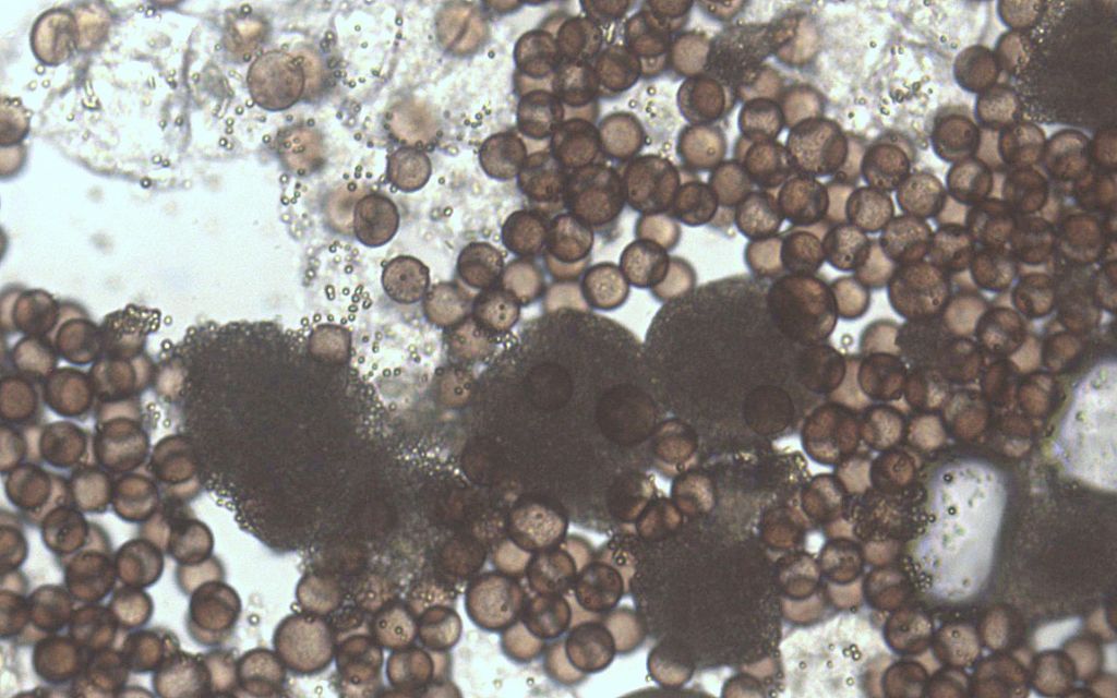 Physarum hongkongense